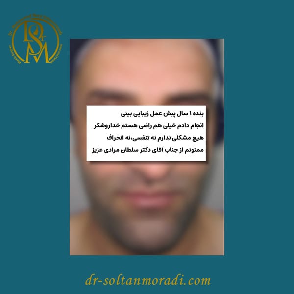 جراحی بینی کج
https://dr-soltanmoradi.com/