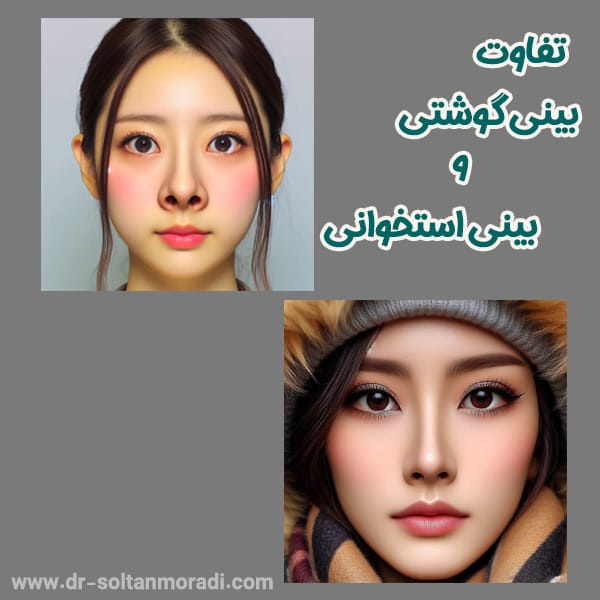 تفاوت بینی گوشتی و استخوانی - https://dr-soltanmoradi.com/