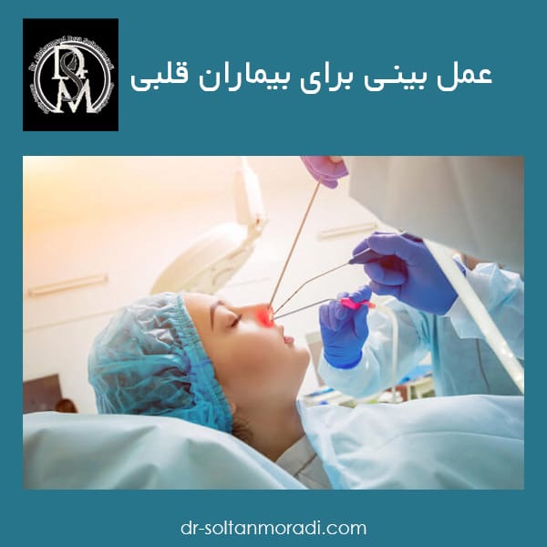 عمل بینی برای بیماران قلبی https://dr-soltanmoradi.com/