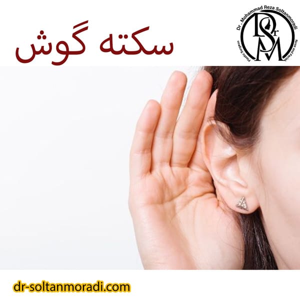 سکته گوش dr-soltanmoradi.com