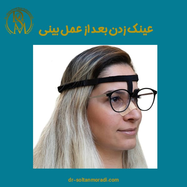 عینک زدن بعد از عمل بینی https://dr-soltanmoradi.com/