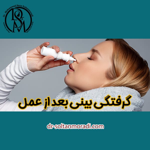 گرفتگی بینی بعد از عمل https://dr-soltanmoradi.com/