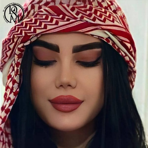 rhinoplasty-39