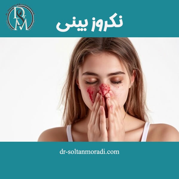 نکروز بینی https://dr-soltanmoradi.com/