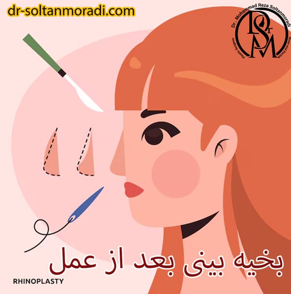 بخیه بینی بعد از عمل https://dr-soltanmoradi.com/