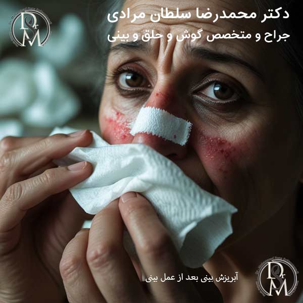آبریزش بینی بعد از عمل بینی