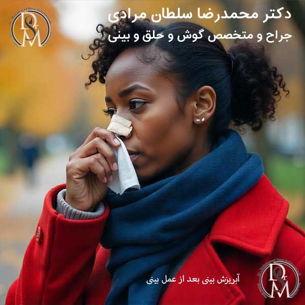 آبریزش بینی بعد از عمل زیبایی بینی