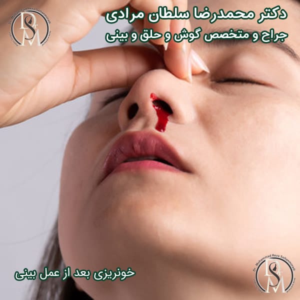 دلایل و پیشگیری از خونریزی بعد از عمل بینی