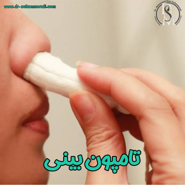 تامپون بینی - دکتر محمدرضا سلطان مرادی